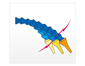 FEATURE1 product image